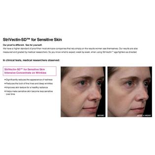 Strivectin Strivectin Sd Intensive Concentrate For Stretch Marks Wrinkles