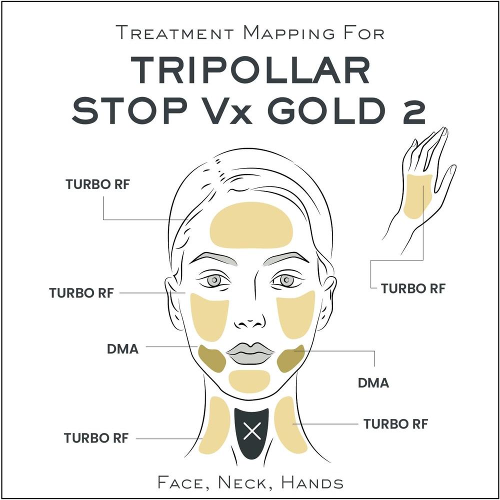 Tripollar Stop Vx Gold2 - Radio Frequency Skin Tightening Machine Face and Neck - at Home Rf Anti-Aging Device Lifting - Gold