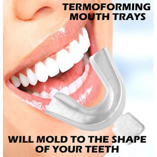 Always White 35% Teeth Whitening Starter Kit Oral ...