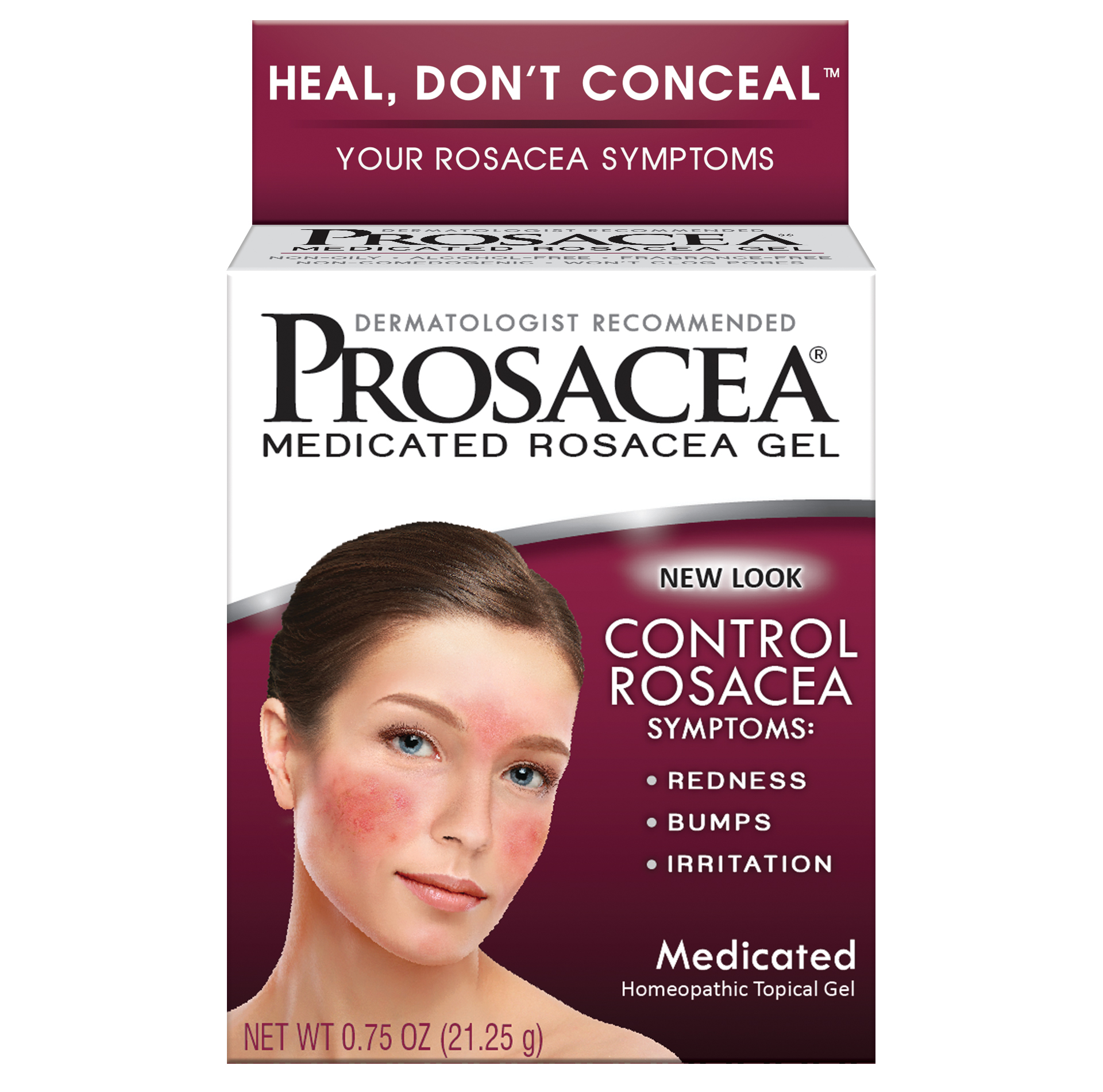 treatment for rosacea