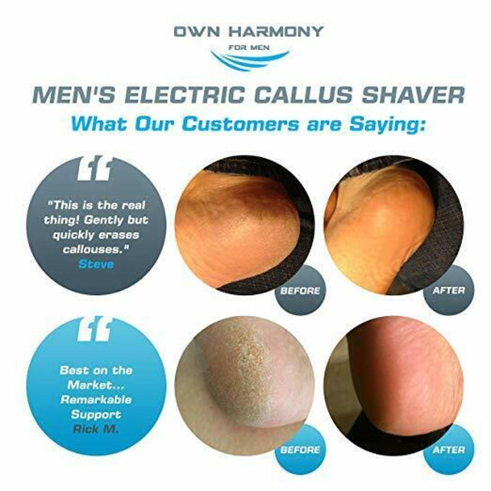 Own Harmony CR900 Men's Electric Callus Shaver