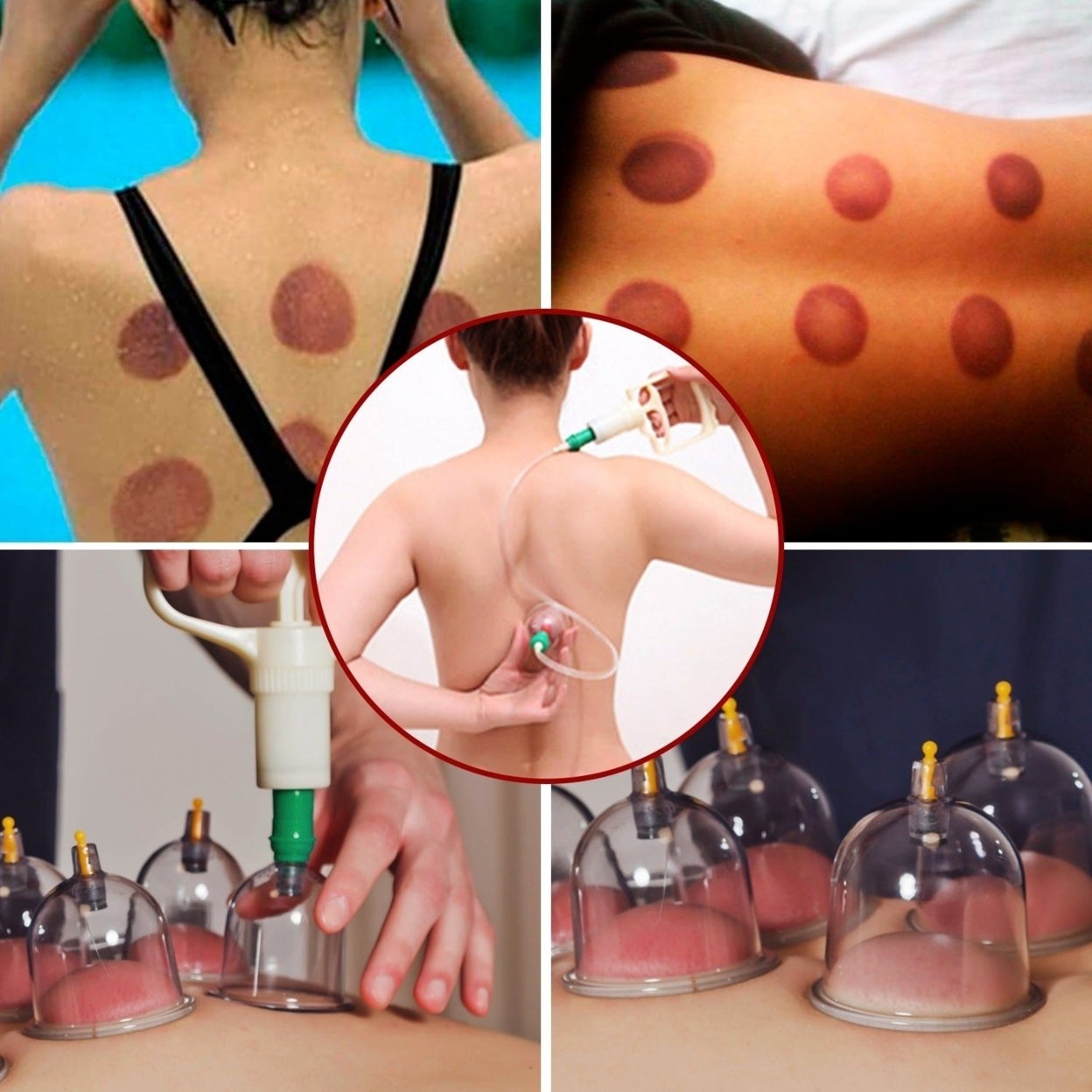 Dsermall 32 Cups Chinese Massage Therapy Cupping Set Body Vacuum Suction Kit Acupoint Massage Kit