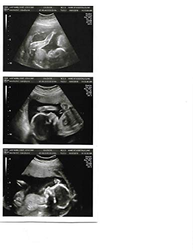 GOWA Prank 2D Customized Fake Ultrasound Strip of 3 Photos