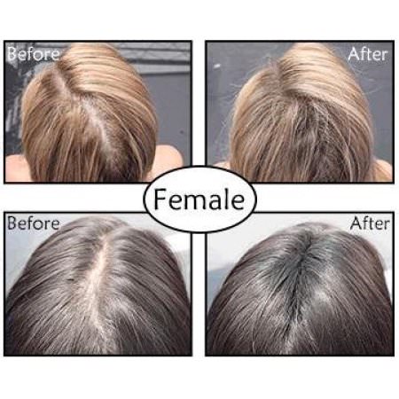 Popular Seller Toppik Hair Building Fibers Medium Brown 97oz