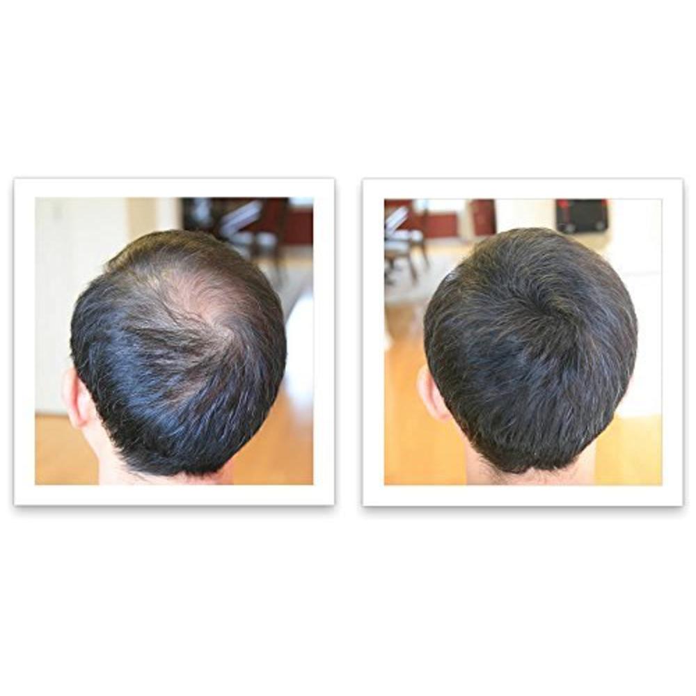 Caboki Hair Loss Concealer - Dark Brown 30G (90-day Supply)