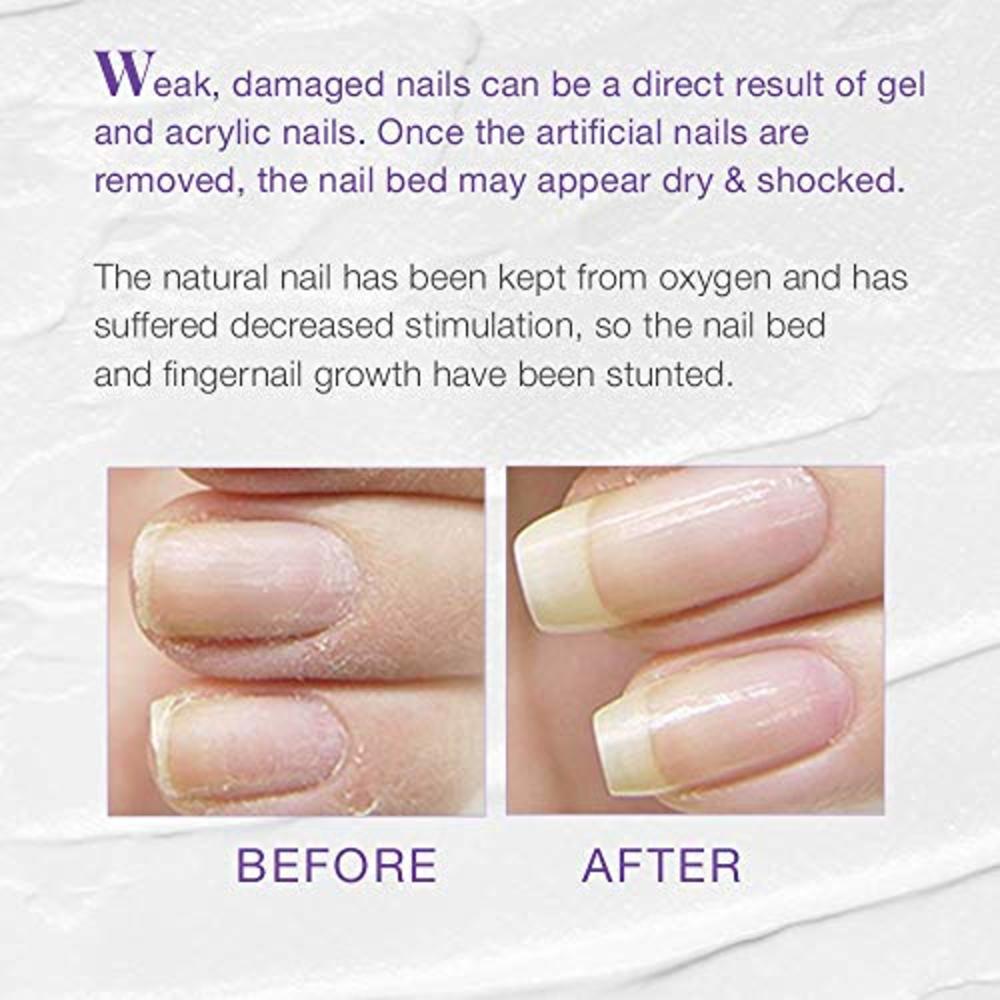 Nail Tek Xtra 4, Nail Strengthener for Weak and Damaged Nails, Prevent Nails  From Peeling, Cracked,