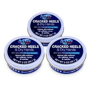 Blue Goo Cracked Heels Dry Hands Intense Skin Softener for