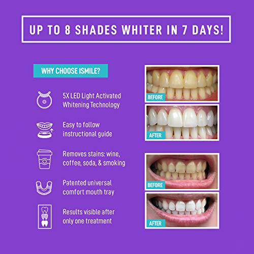 iSmile Whitening iSmile Teeth Whitening Kit - LED Light, 35% Carbamide Peroxide, (3) 3ml Gel Syringes, (1) Remineralization Gel, and Tray.