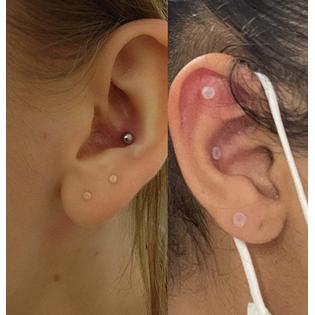 MODRSA Clear Earrings Stud 20g Plastic Earrings Studs Earring