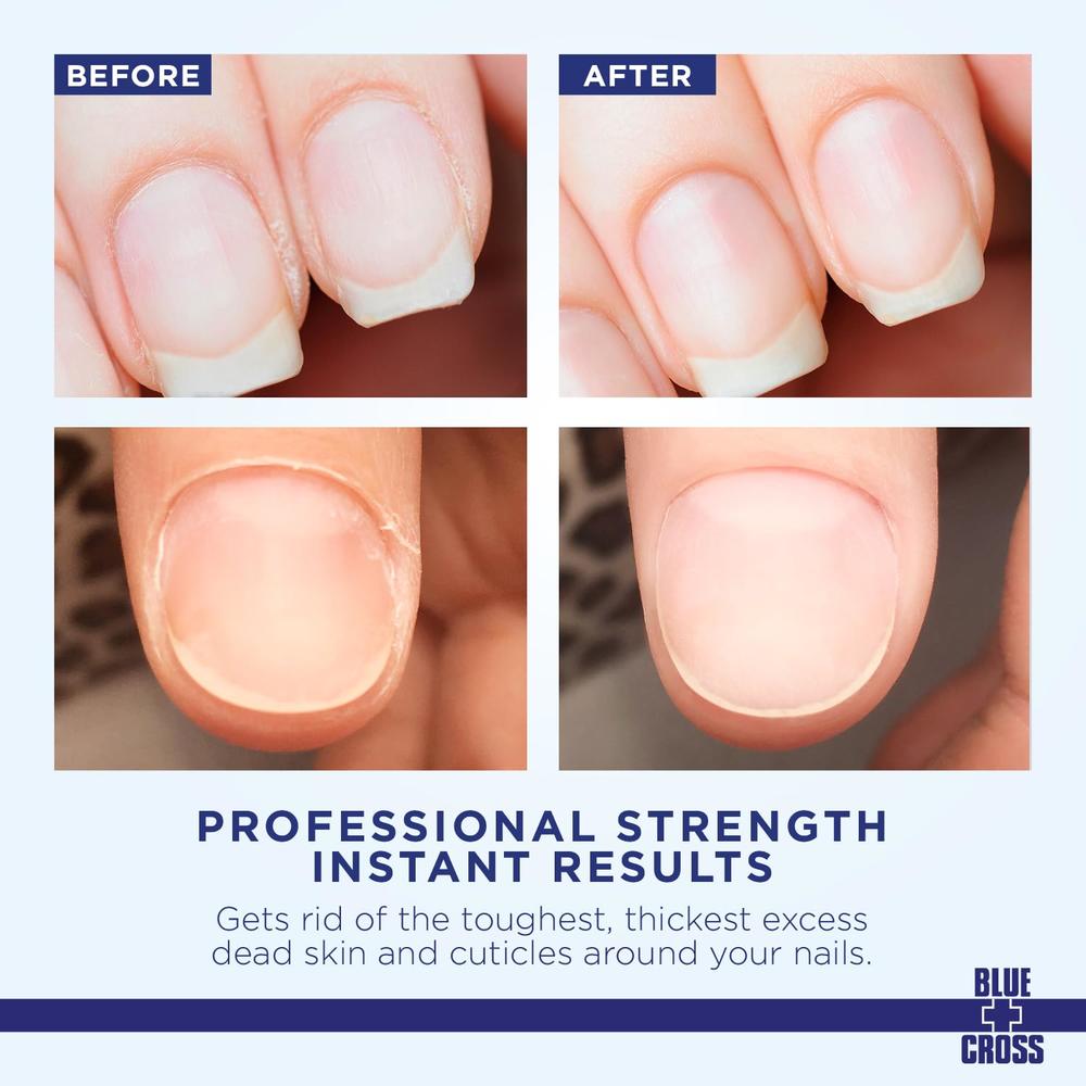 Blue Cross Professional Nail Care, Hydrating, Moisturizing, Strengthening Liquid Cuticle Remover + Softener with Lanolin for Bri