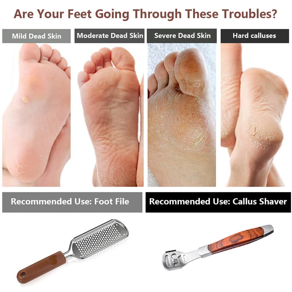 Vusoset Colossal Foot Rasp & Wood Handle Callus Shaver (10 Replacement & 1 Foot File Heads), Pedicure Kit, Heel Scraper For Feet, Callus
