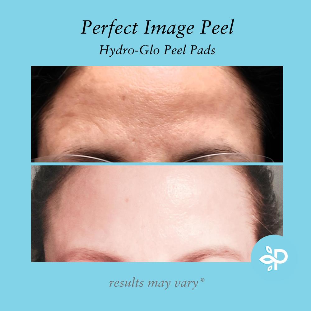 PERFECT IMAGE Hydro-Glo 40% Peel Pads, Enhanced with Lactic Acid, Mandelic Acid, Glutathione, Kojic Acid, Licorice, Papaya, Pineapple, and Bea