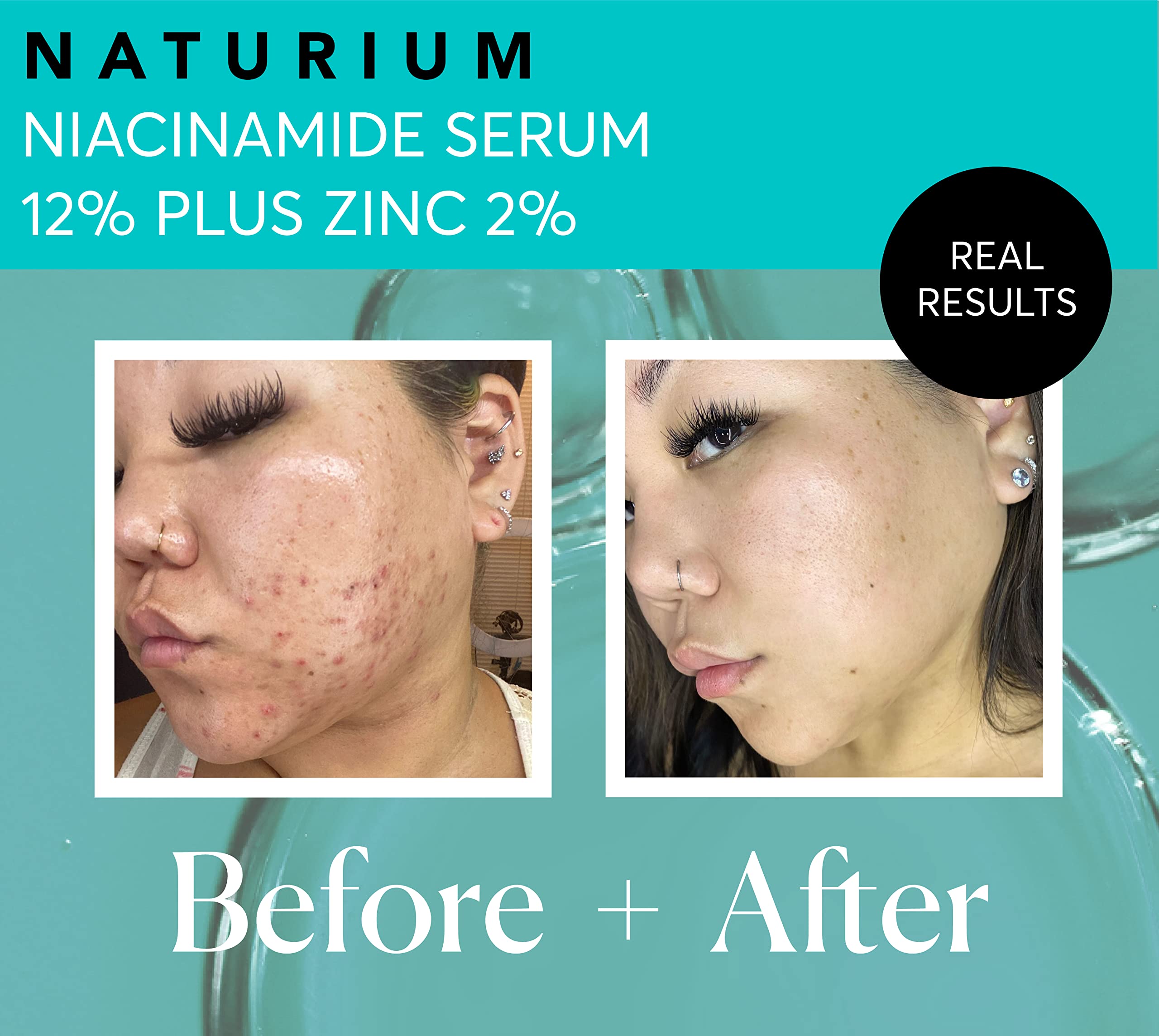 Naturium Niacinamide Face Serum 12% Plus Zinc 2%, Skin Complexion Treatment & Pore Minimizer, with Hyaluronic Acid & Vitamin E, 