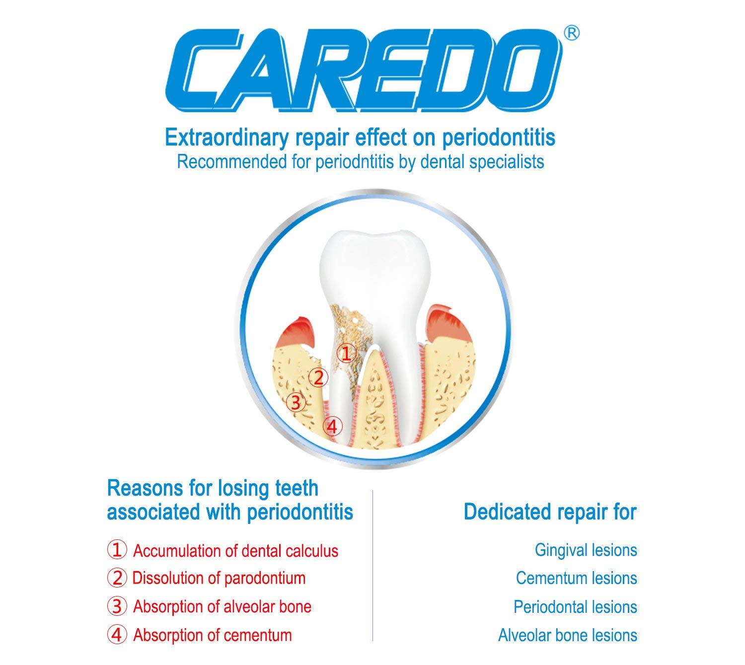 CAREDO Healing Periodontitis Treatment At Home Toothpaste, Periodontal Disease Treatment 3.52oz, Gingivitis Treatment & Gum Dise