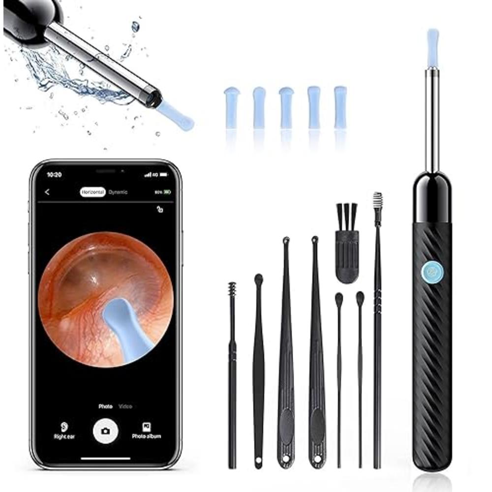 Loyker Ear Wax Removal, Ear Cleaner with Camera with 1080P, Otoscope with Light, Ear Wax Removal Kit with 6 Ear Pick, Ear Camera for iP