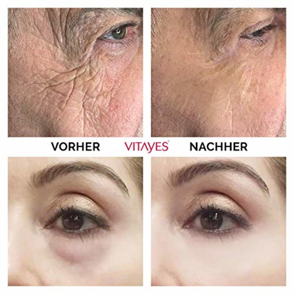Vitayes Instant Ageback Rapid Effect On Dark Circles & Under-eye Bags & Puffiness | Visibly Reduce Signs of Aging Wrinkles & Fin