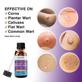 Pureskin Corn removers for feet Extra Strength, Foot Corn Remover