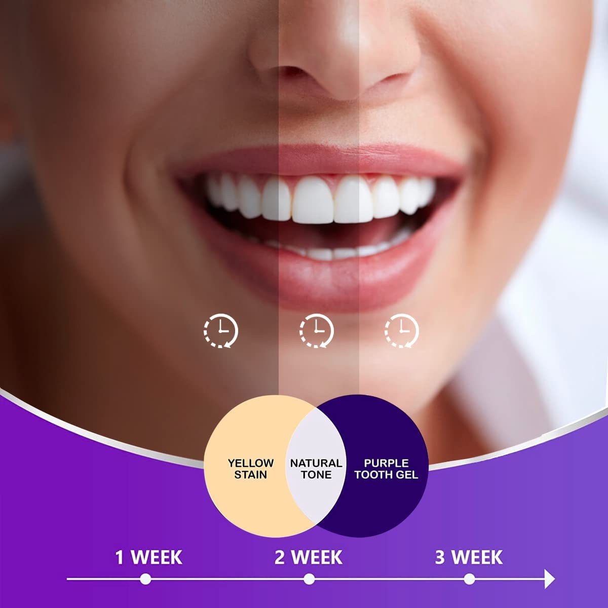 MEOLY Purple Toothpaste for Teeth Whitening - Premium Whitener, Non-Abrasive, color corrector - Tooth Stain Removal, Teeth Whitening K